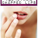 Tips To Avoid Chapped Lips