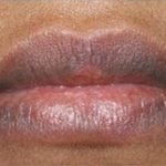 Natural Remedies to Get Rid of Dark Lips